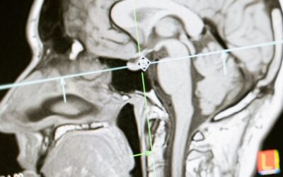 Home 2 Optimize Brain Health for Leadership Success